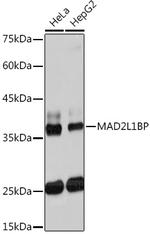 MAD2L1BP Antibody in Western Blot (WB)