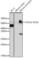 ATG12 Recombinant Rabbit Monoclonal Antibody (9R8W2)