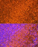 EBI3 Antibody in Immunohistochemistry (Paraffin) (IHC (P))