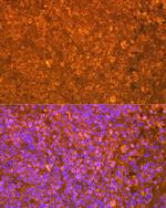 EBI3 Antibody in Immunohistochemistry (Paraffin) (IHC (P))