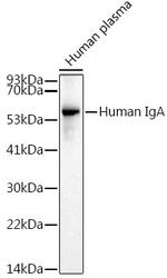 Human IgA Recombinant Rabbit Monoclonal Antibody (10Q6M3)