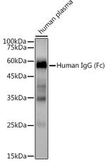 Human IgG Recombinant Rabbit Monoclonal Antibody (1U6H0)