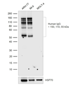 Human IgG Recombinant Rabbit Monoclonal Antibody (1U6H0)