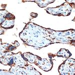 NAIP Recombinant Rabbit Monoclonal Antibody (6B9M10)