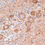 Plectin Antibody in Immunohistochemistry (Paraffin) (IHC (P))