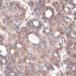 Plectin Antibody in Immunohistochemistry (Paraffin) (IHC (P))