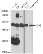 RORB Recombinant Rabbit Monoclonal Antibody (7J9T7)