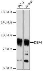 ASK Recombinant Rabbit Monoclonal Antibody (0S8I5)
