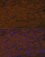 TMOD2 Recombinant Rabbit Monoclonal Antibody (5E7G5)