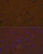 Talin 2 Antibody in Immunohistochemistry (Paraffin) (IHC (P))