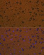 Talin 2 Antibody in Immunohistochemistry (Paraffin) (IHC (P))