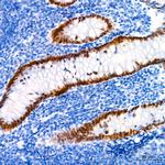 SATB2 Antibody in Immunohistochemistry (Paraffin) (IHC (P))