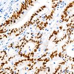 SATB2 Recombinant Rabbit Monoclonal Antibody (6X1T3)