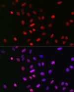 H3K18me1 Antibody in Immunocytochemistry (ICC/IF)