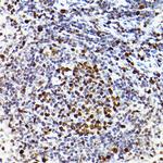 MCM2 Antibody in Immunohistochemistry (Paraffin) (IHC (P))