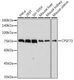 CPSF3 Recombinant Rabbit Monoclonal Antibody (4S4P2)