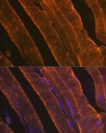 ACTA1 Antibody in Immunohistochemistry (Paraffin) (IHC (P))
