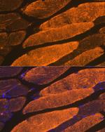 ACTA1 Recombinant Rabbit Monoclonal Antibody (8B9Q6)