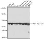 ACTA1 Antibody in Western Blot (WB)