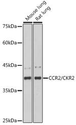 CCR2 Recombinant Rabbit Monoclonal Antibody (10L1L6)