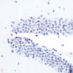 SIN3A Antibody in Immunohistochemistry (Paraffin) (IHC (P))
