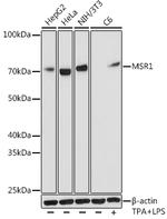 CD204 Recombinant Rabbit Monoclonal Antibody (10O8B0)