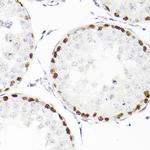 WT1 Recombinant Rabbit Monoclonal Antibody (6L9X6)