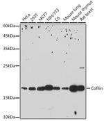 Cofilin Recombinant Rabbit Monoclonal Antibody (4M1Z9)