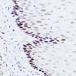 p73 Recombinant Rabbit Monoclonal Antibody (7L1V7)