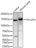 Vinculin Antibody in Western Blot (WB)