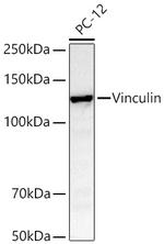 Vinculin Antibody in Western Blot (WB)