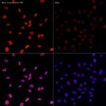 H3K27ac Recombinant Rabbit Monoclonal Antibody (2V10N10)