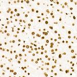 H3K27ac Antibody in Immunohistochemistry (Paraffin) (IHC (P))