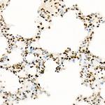 H3K27ac Antibody in Immunohistochemistry (Paraffin) (IHC (P))