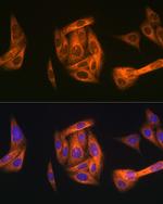 TAB1 Recombinant Rabbit Monoclonal Antibody (2W0P2)