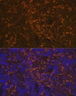 LSP1 Antibody in Immunohistochemistry (Paraffin) (IHC (P))