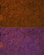 LSP1 Antibody in Immunohistochemistry (Paraffin) (IHC (P))