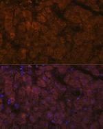 ADAMTS13 Antibody in Immunohistochemistry (Paraffin) (IHC (P))