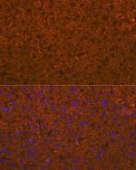 ADAMTS13 Recombinant Rabbit Monoclonal Antibody (7B2Z8)