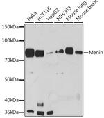 Menin Recombinant Rabbit Monoclonal Antibody (5M7L9)
