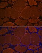 Thyroglobulin Antibody in Immunohistochemistry (Paraffin) (IHC (P))