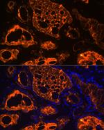 Thyroglobulin Antibody in Immunohistochemistry (Paraffin) (IHC (P))