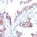 IGF2BP3 Recombinant Rabbit Monoclonal Antibody (8K4H5)