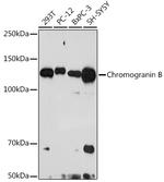 Chromogranin B Recombinant Rabbit Monoclonal Antibody (5N6T1)