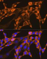 YBX1 Recombinant Rabbit Monoclonal Antibody (9J7M4)
