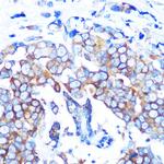 HDAC6 Recombinant Rabbit Monoclonal Antibody (9V1W2)