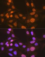 APC6 Recombinant Rabbit Monoclonal Antibody (7Y1Y10)