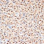 APC6 Antibody in Immunohistochemistry (Paraffin) (IHC (P))
