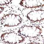 APC6 Antibody in Immunohistochemistry (Paraffin) (IHC (P))