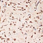 APC6 Antibody in Immunohistochemistry (Paraffin) (IHC (P))